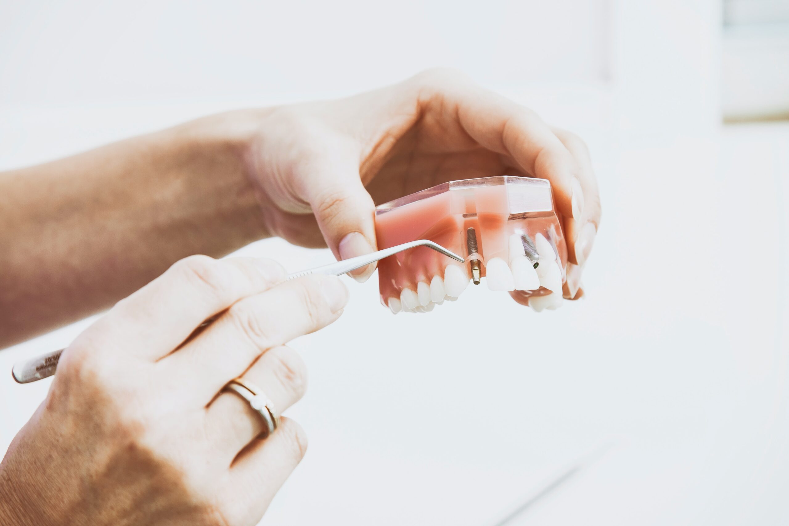 dentist explaining dental implants