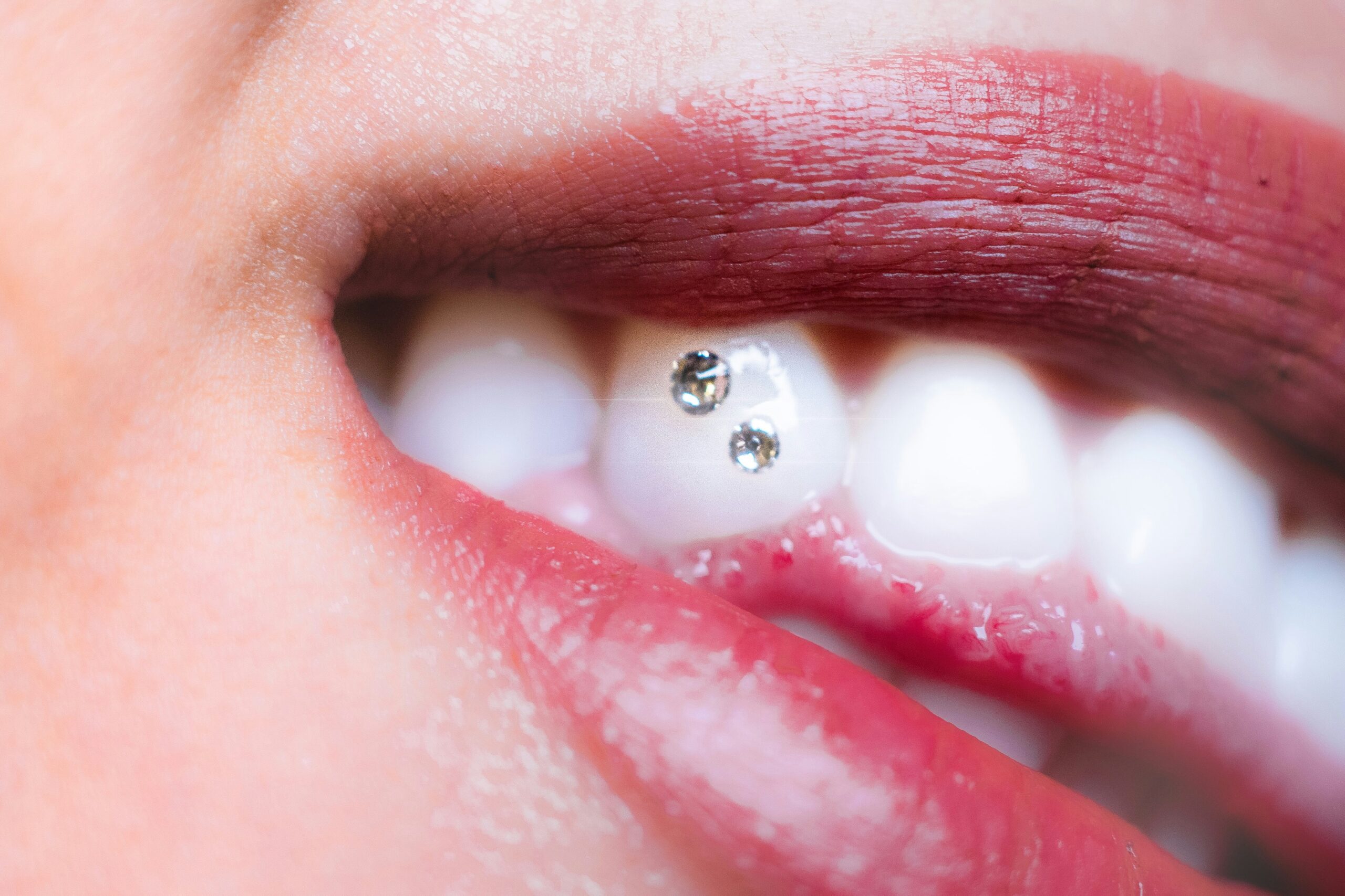 Tooth Piercing: